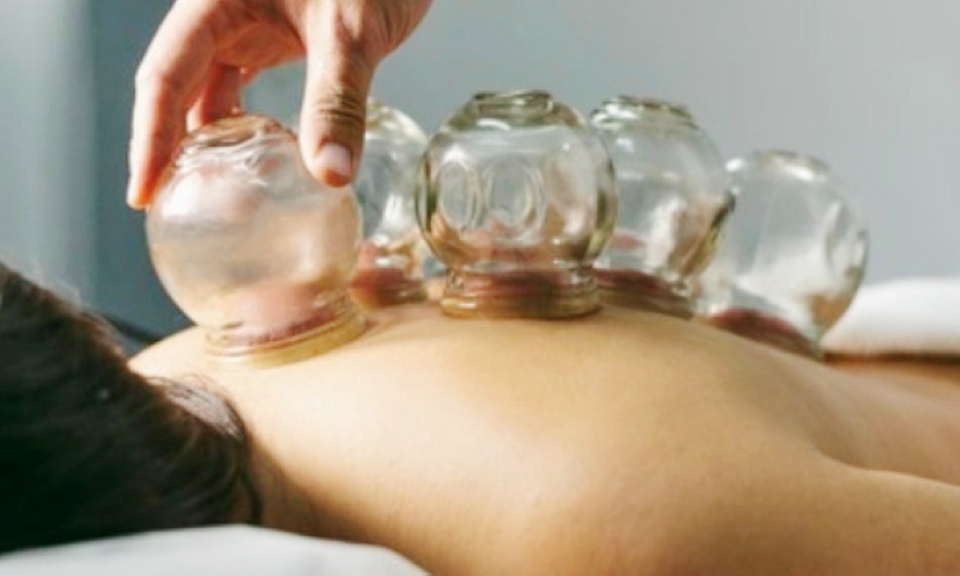 NO WAIT DOCTORS Offers One or Two Sessions of 60-Minutes Medical Cupping (Up to 20% Off)