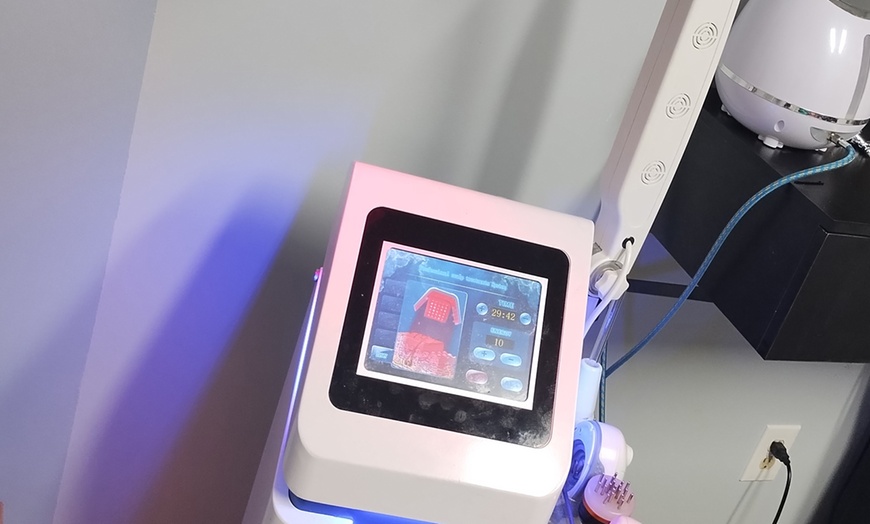 Image 4: One or Two Sessions of Laser Hair Restoration Plus Consultation