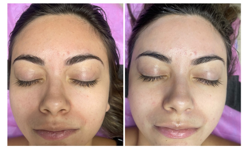 Image 8: Relax with Customized 60-Minute Advanced Facial of Choice One or Two!