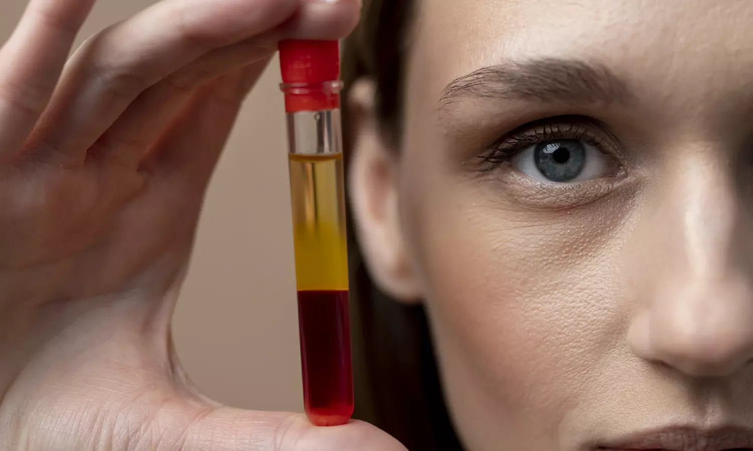 Up to 58% Off on PRP Facial / Vampire Face Tightening at Nova Luna Wellness - Second Medium
