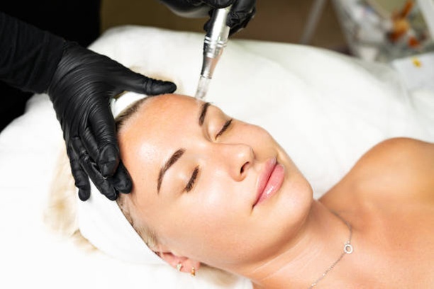 Revitalize Your Skin with One or Three Microneedling & PRP Treatment