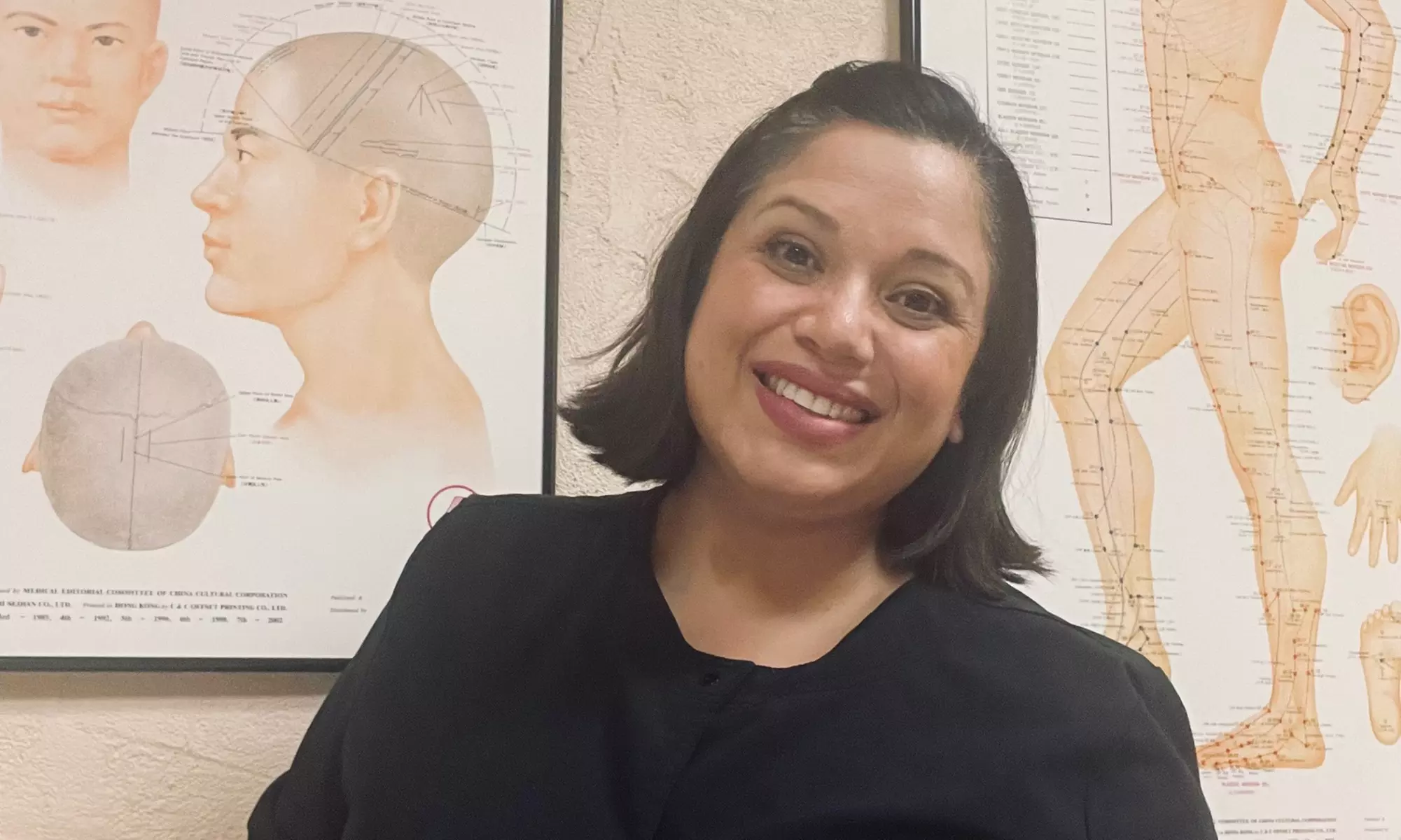 Feel Relaxed with a Single Acupuncture Session