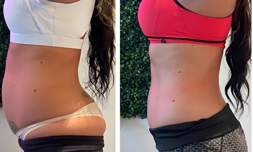 Image 4: 1, 3 or 6 Signature Body Contouring Sessions of Your Choice 45 -90 Min