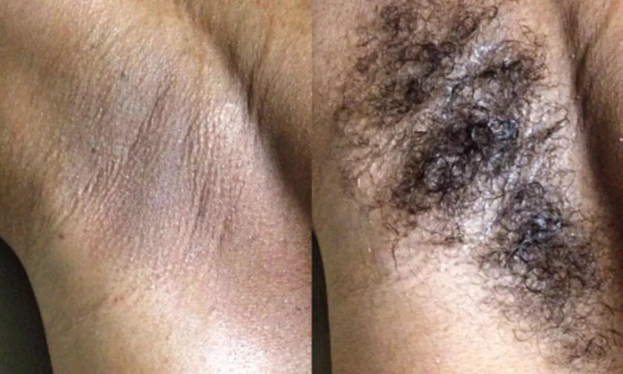 Get Smooth Skin with Brazilian Wax, Underarm Wax, or Wax and Vajacial