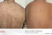 Up to 53% Off Eight Laser Hair Removal Sessions for XS to XL Area at Lotus Health & Aesthetics Spa - Second Medium
