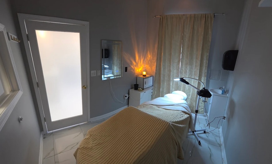 Image 3: Up to 55% Off on Micro-Needling at The Facial Experience