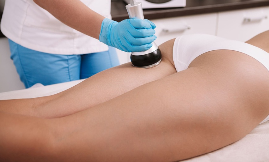 Image 3: 3 o 6 sesiones de combo reductor con cavitación, presoterapia y masaje