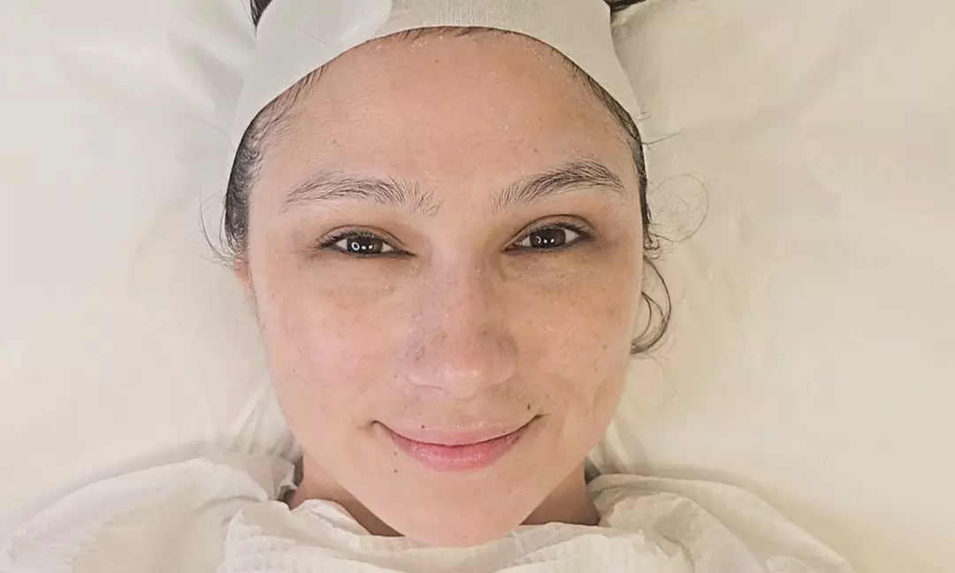 Experience Radiance: One or Three Light or Deep Chemical Peels