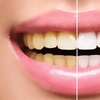 Image 2: Teeth Whitening, Semi Permanent Lip Blush or Powder Brows Perfection 