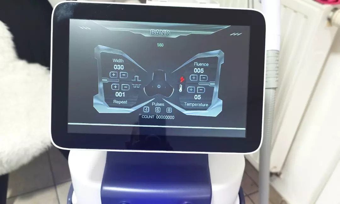 Stralende en verjongde huid met professionele HIFU behandelingen