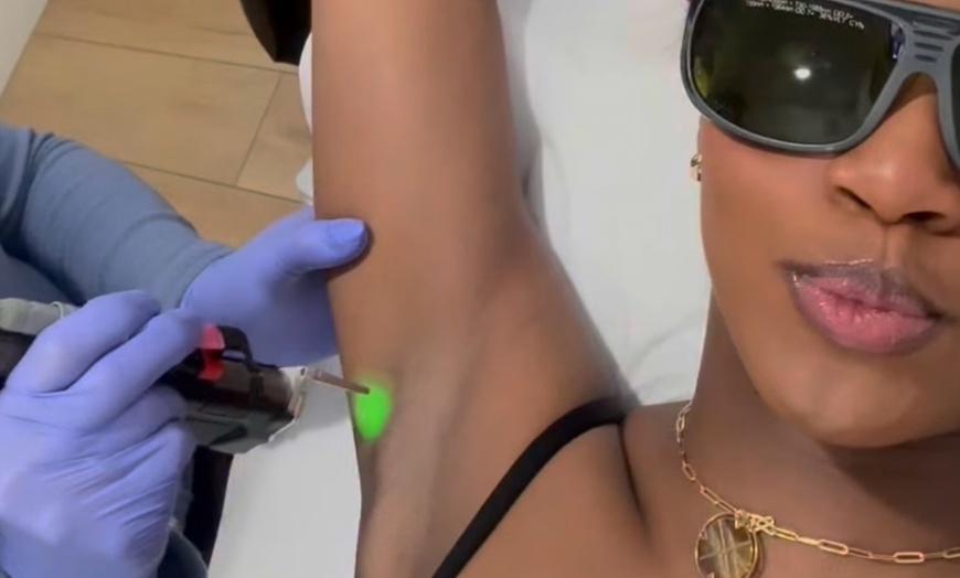 Image 7: Get Smooth Skin w/ 4 or 6 LHR Session for Small, Medium, or Large Area