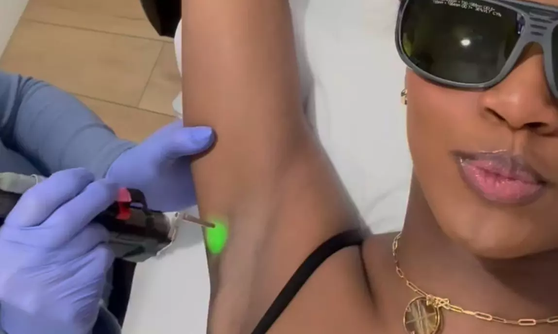 Get Smooth Skin w/ 4 or 6 LHR Session for Small, Medium, or Large Area