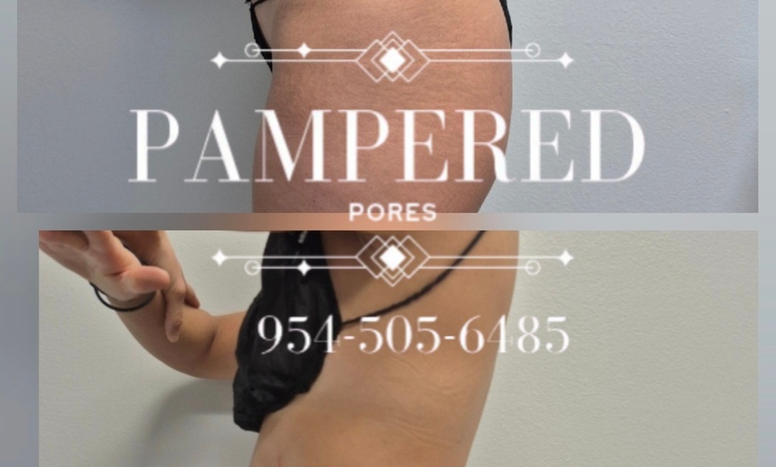 Image 3: Get 1, 3, or 6(60 Min) Ultrasonic Cavitation, RF & Laser Lipo Sessions