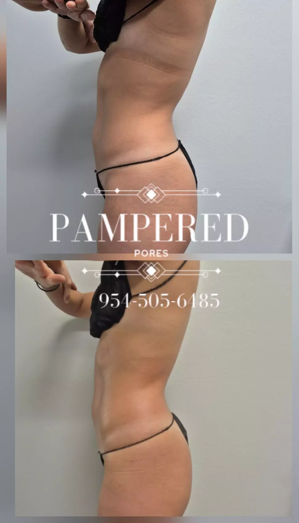 Get 1, 3, or 6(60 Min) Ultrasonic Cavitation, RF & Laser Lipo Sessions