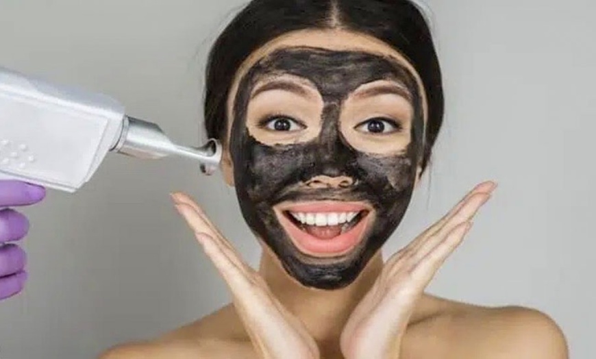 Image 3: Ervaar een diepe gelaatsverzorging met carbonpeeling