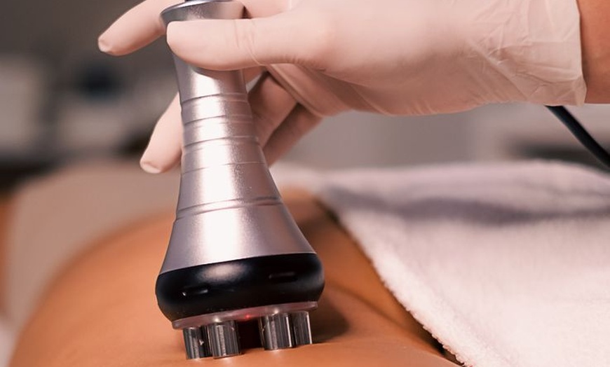 Image 4: Youthful Radiance with One HIFU Session for Body, or Full Face & Neck