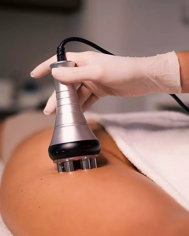 Youthful Radiance with One HIFU Session for Body, or Full Face & Neck