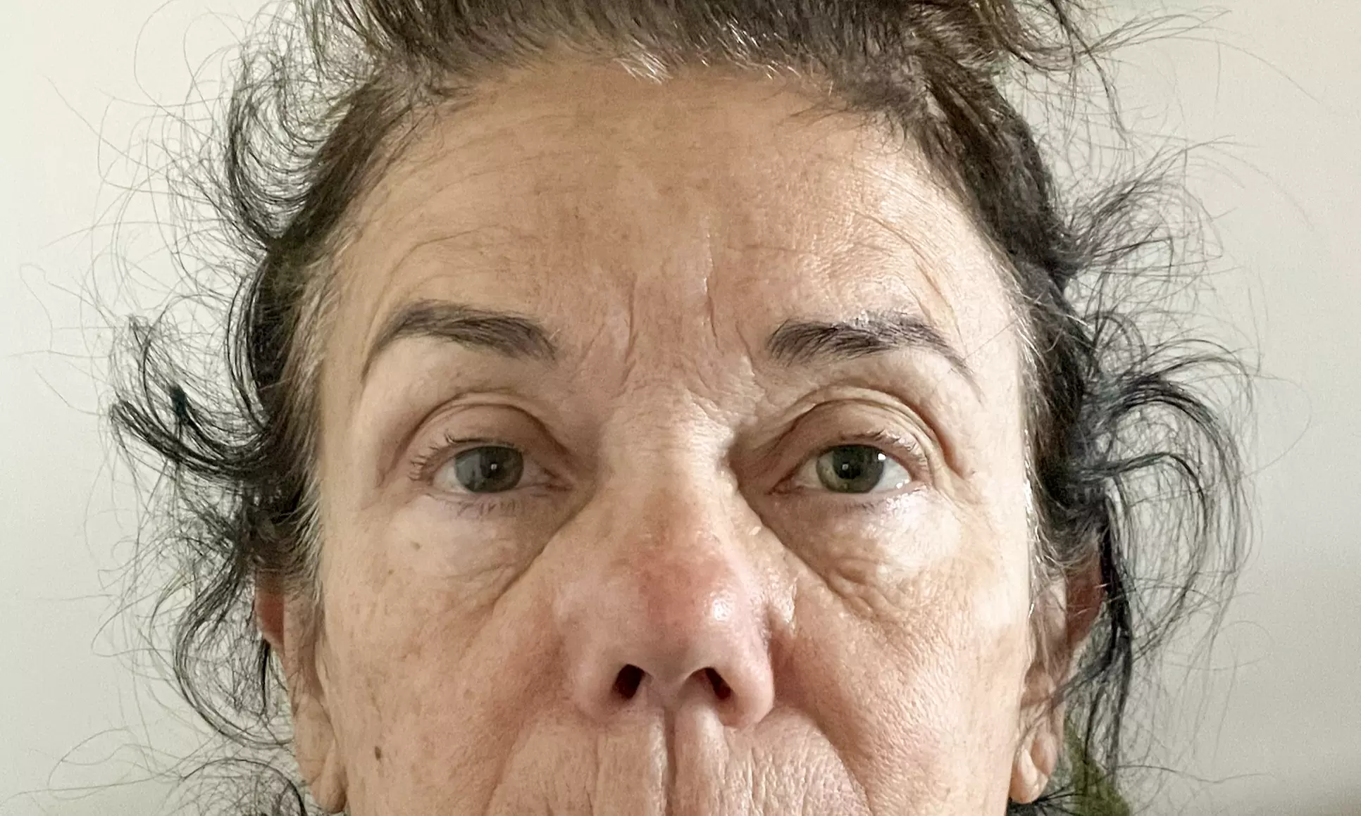 Youthful/Beauty Enhanced Face & Skin Therapy