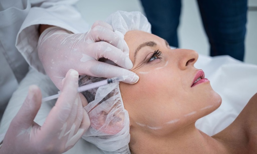 Image 1: Up to 40%  Botox  at Alie Medical Aesthetics