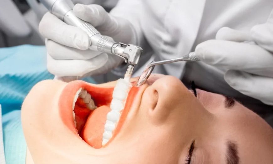 Image 3: Check Up, Clean, X-Ray with Kit or Clear Aligners Teeth Straightening