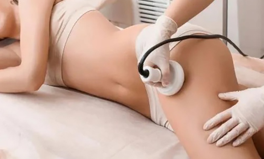 Image 1: 2 o 4 sesiones de Tactum, radiofrecuencia y presoterapia