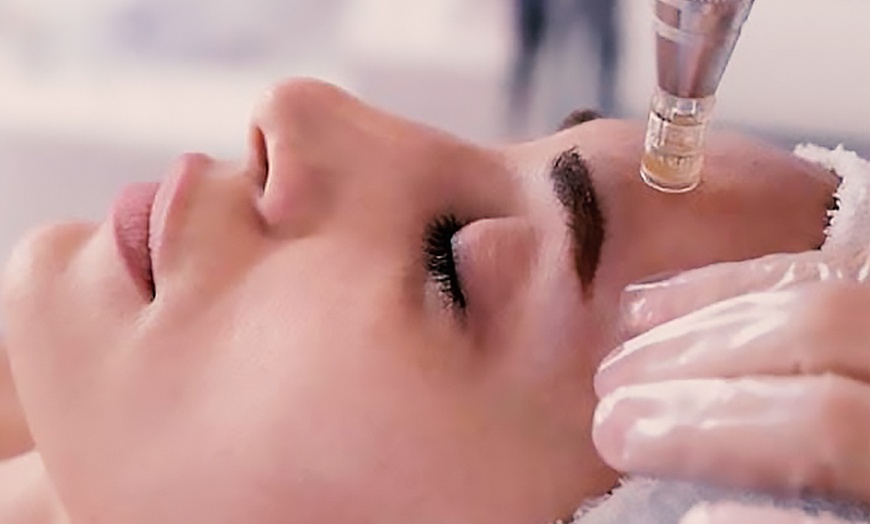 Image 2: Micro-Needling or Dermapen Micro-Needling w/ Hyaluronic Serum with LED