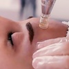 Image 2: Micro-Needling or Dermapen Micro-Needling w/ Hyaluronic Serum with LED