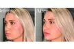 Fresno's 5-Star Botox Experience. See Your Exclusive Savings Inside! - Second Medium