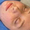 Image 1: One, Two, Three or Four Professional Grade Pro Chemical Peels