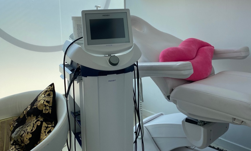 Image 7: Radiofrecuencia Indiba sola o con presoterapia y electroestimulación 