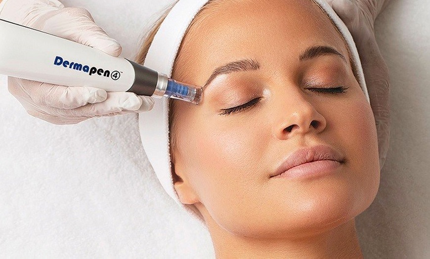 Image 3: 1, 2 o 3 sesiones de microneedling facial de vitaminas con Dermapen