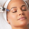 Image 3: 1, 2 o 3 sesiones de microneedling facial de vitaminas con Dermapen