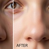 Image 4: 15 or 30-Min Skin Tag, Brown Spot & Spider Vein Removal Up to 6 Spots