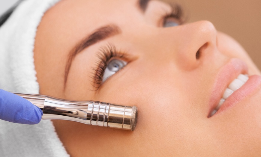 Image 1: Achieve Radiant Skin: Microdermabrasion Facial