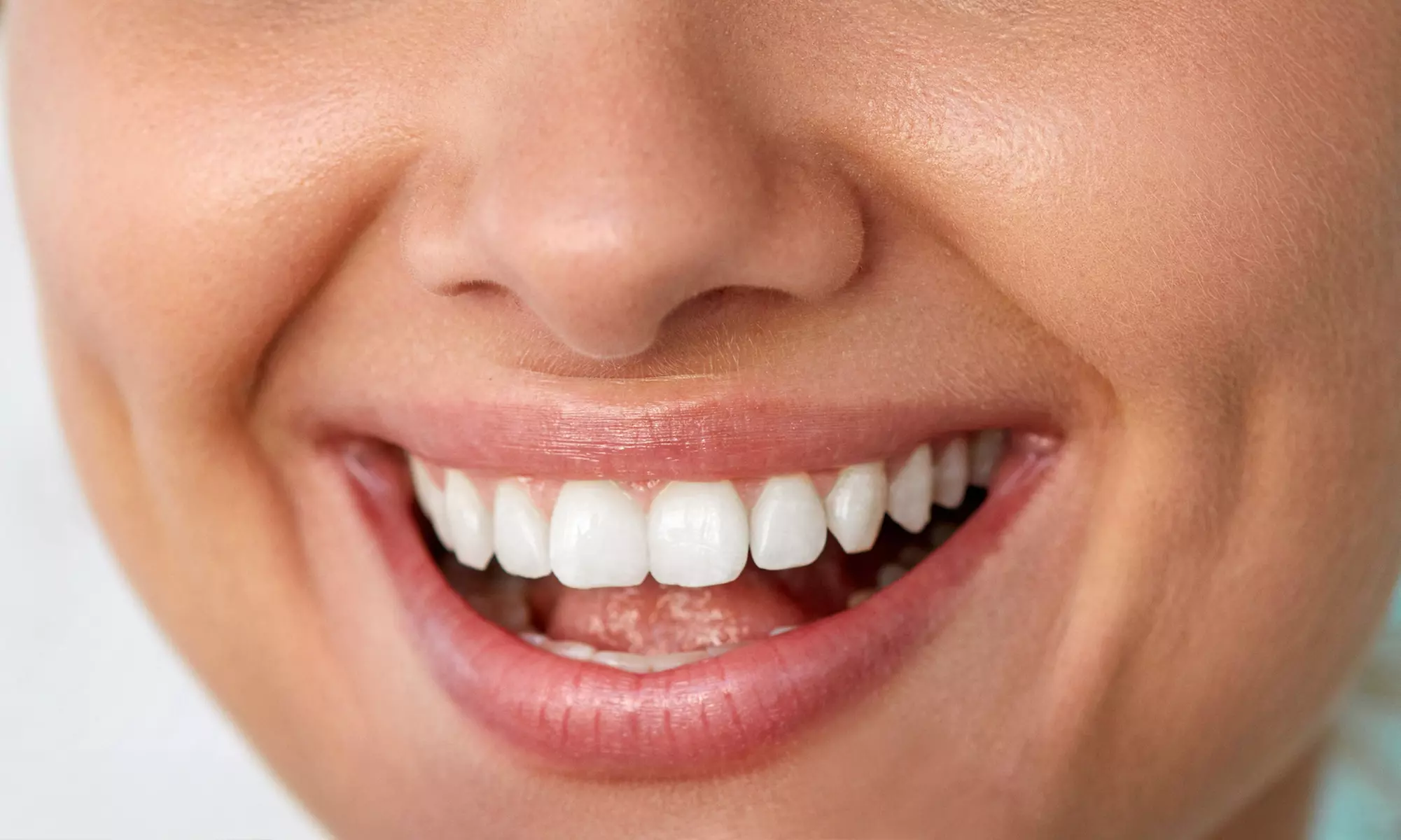 Blanqueamiento dental LED con limpieza bucal y fluorización