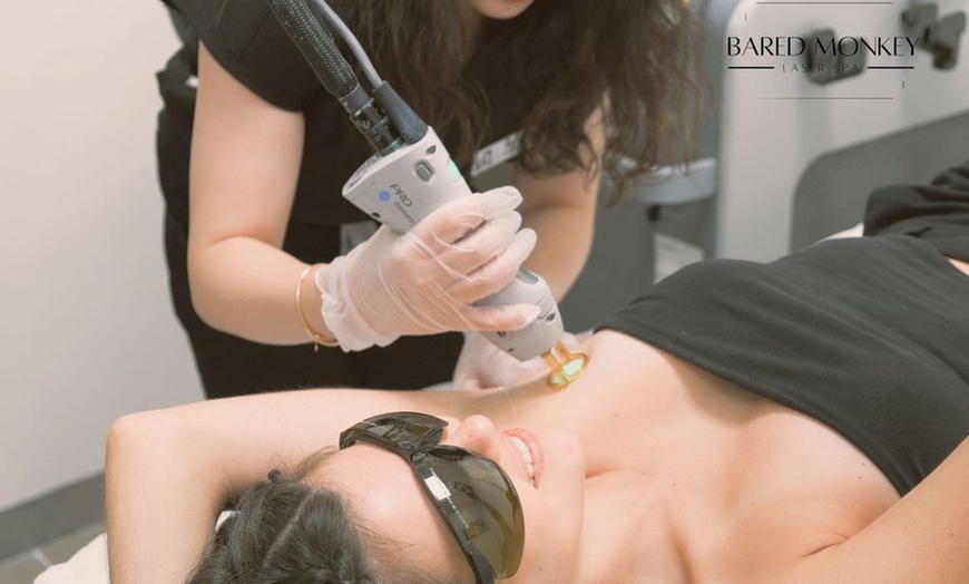 Image 2: Smooth, Hair-Free Skin with Laser Hair Removal at Bared Monkey