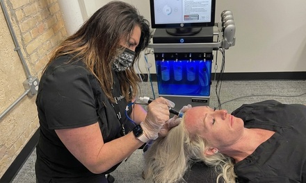 One 30 Minute Session (Customized Smart Peel technology) - Glam by Tam Aesthetics