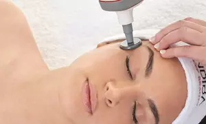 1 o 2 sesiones de radiofrecuencia facial o corporal Indiba para 1 persona, ahorra hasta un 58%