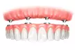$29 for Cosmetic Dentistry Consultation at Advanced Dental Services, Four Locations - Image 3