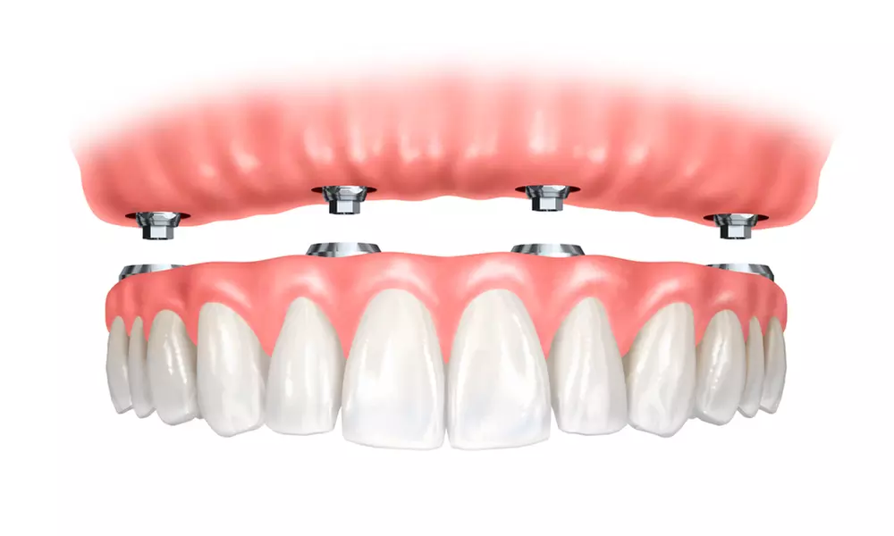 Cosmetic Dentistry Consultation