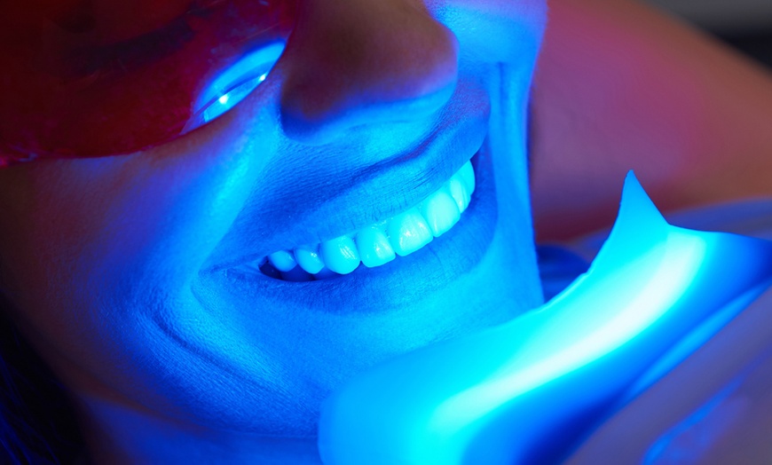 Image 2: Experience a Brighter Smile with One or Three Teeth Whitening Sessions
