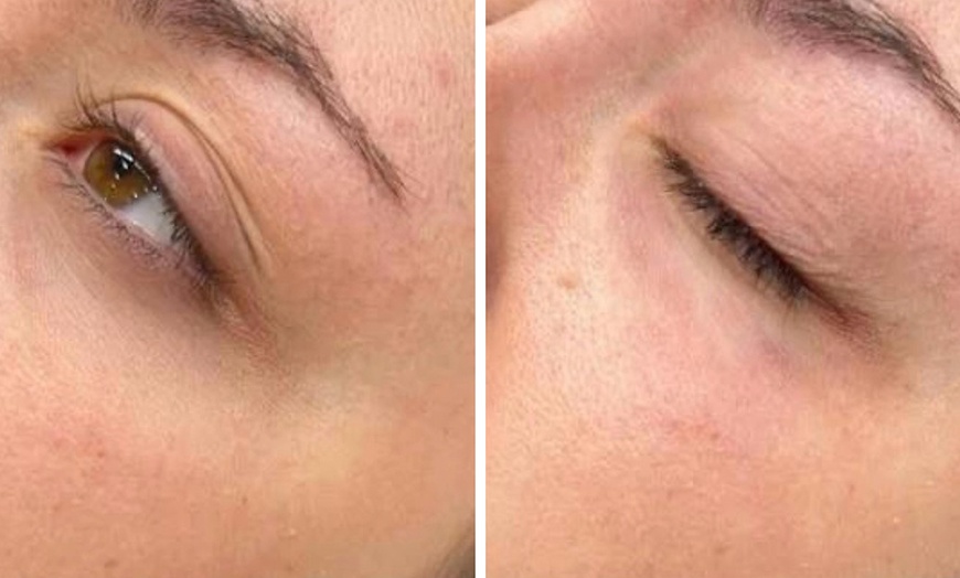 Image 4: Hydra Facial, Lumi Eyes, or Lumi Pro for a Radiant Glow!