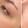 Image 4: Hydra Facial, Lumi Eyes, or Lumi Pro for a Radiant Glow!