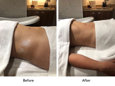 Lymphatic Drainage Massage and Reduction of Waist and Abdomen measurements NOT APPLICABLE FOR POST OP - SERENITY SPA AR LLC