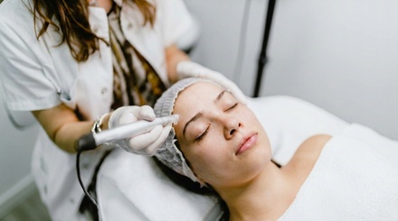 One Session - PRP with Microneedling - La Belle Medical Spa