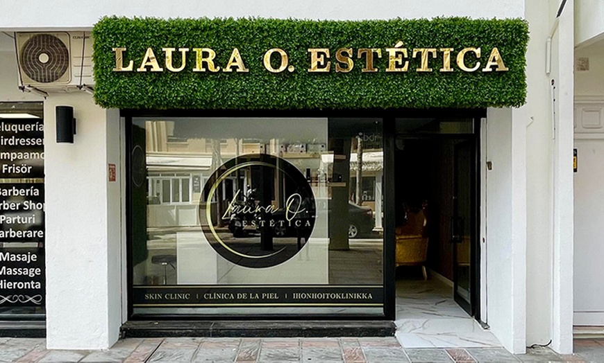 Image 2: 1 o 3 sesiones de lifting facial no quirúrgico con luz pulsada intensa 