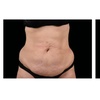 Image 4: One Session Electromagnetic Body Sculpting on One, Two or Four Areas