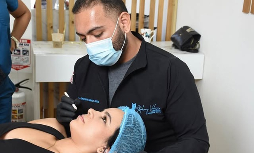 Image 4: Lip Flip or 20, 40 or 60 Units of Botox 