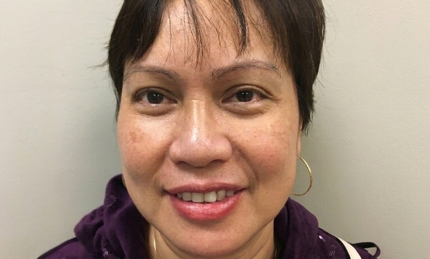 Image 2: 1, 3, or 5 Fractional Laser Skin Resurfacing Sessions for Full Face