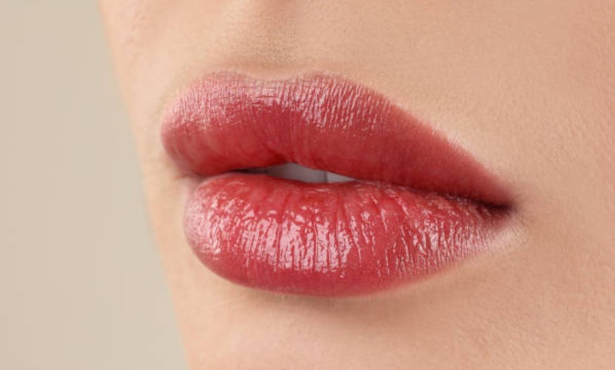 Image 16: Infiltración de 1 o 2 viales de tratamiento de relleno facial para 1